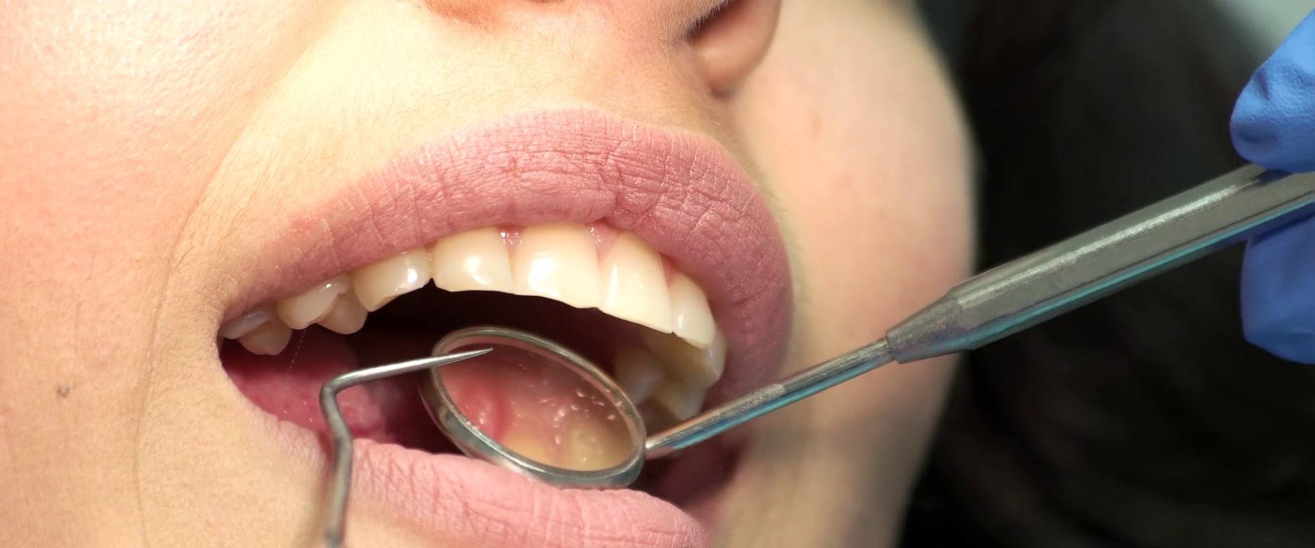 Understanding Tooth Numbers and Quadrants: A Guide to Dental Jargon