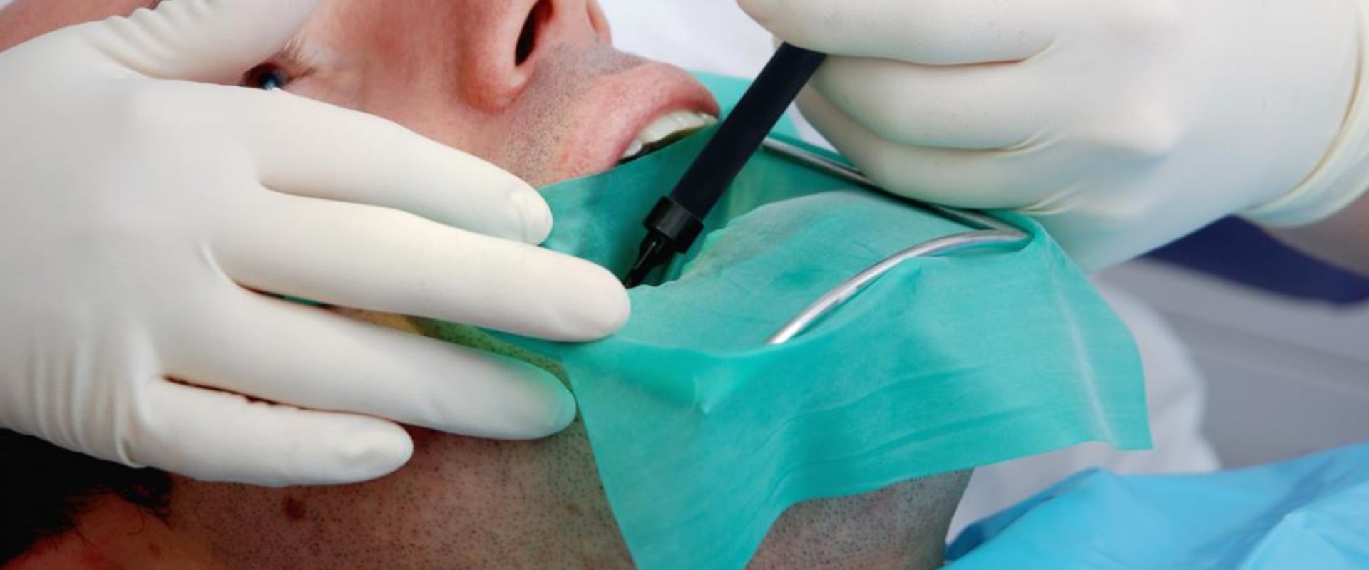 What is Root Canal Therapy and Who Does It?