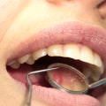 Understanding Tooth Numbers and Quadrants: A Guide to Dental Jargon