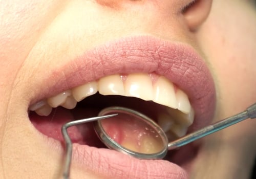 Understanding Tooth Numbers and Quadrants: A Guide to Dental Jargon