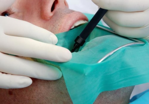 What is Root Canal Therapy and Who Does It?